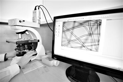 顯微鏡下，聚酯纖維很光亮，表面有斑點，粗細非常均勻。
