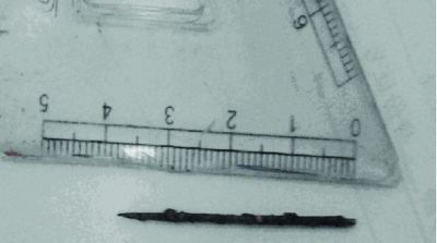 取出的繡花針已發(fā)黑生銹。