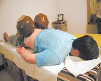 拔泡菜壇子火罐。