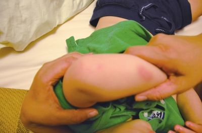 孩子身上有多處明顯傷痕。京華時(shí)報(bào)讀者供圖