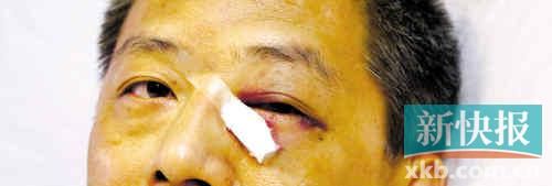 ■這起醫(yī)鬧事件，受傷的遠(yuǎn)遠(yuǎn)不只是熊旭明醫(yī)生的身體。