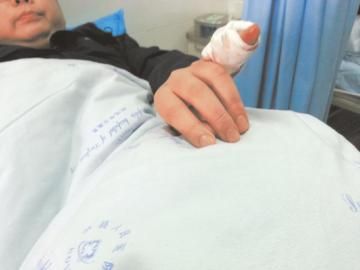 實習醫(yī)生陳洪左手的小拇指肌腱斷裂。