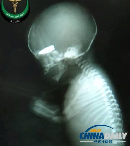 外媒曝敘軍拿孕婦當(dāng)游戲標(biāo)靶 射死胎兒獲香煙