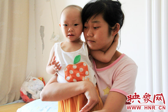 孩子和媽媽在一起，她的右眼已經(jīng)失明。