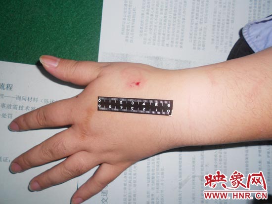 為幫助無證駕駛的朋友逃避處罰，新鄉(xiāng)的王某竟對執(zhí)勤民警大打出手，還將一名民警的手臂咬傷