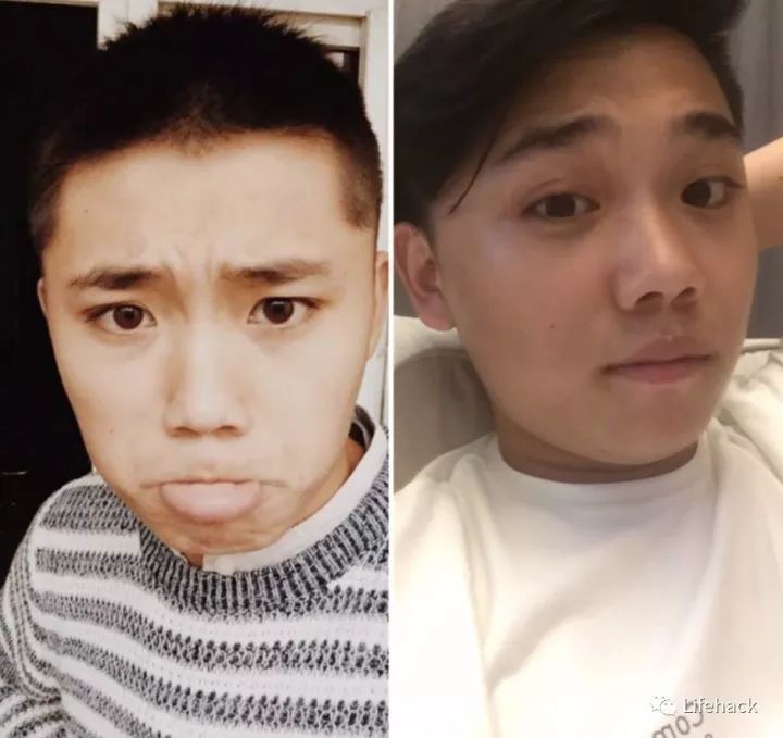 長(zhǎng)胖20斤，臉型怎么變？這些例子看完扎心了！