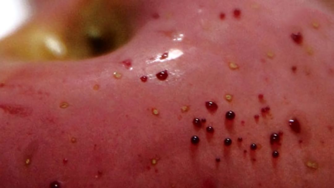 嚇懵！女子用熱水泡蘋果結(jié)果冒出血珠 咋回事？