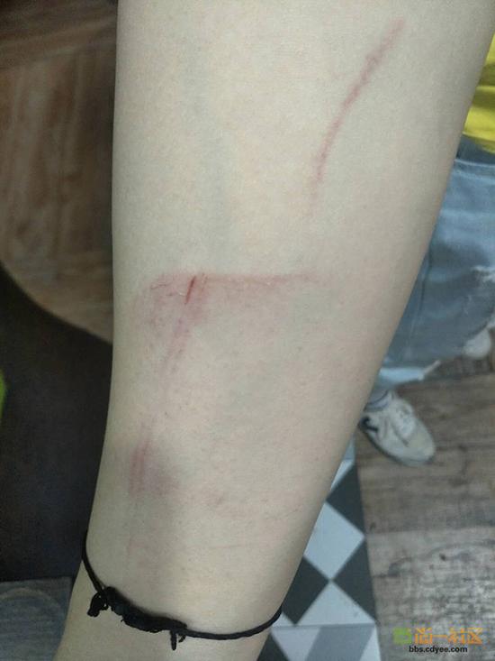 女網(wǎng)友舉報(bào)網(wǎng)帖中出示的被打后照片。