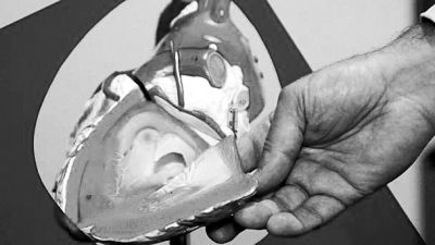 威廉斯領(lǐng)導(dǎo)的研究團(tuán)隊(duì)已經(jīng)利用人體脂肪干細(xì)胞，成功3D打印出心臟血管和心臟瓣膜，待一顆心臟的所有部件打