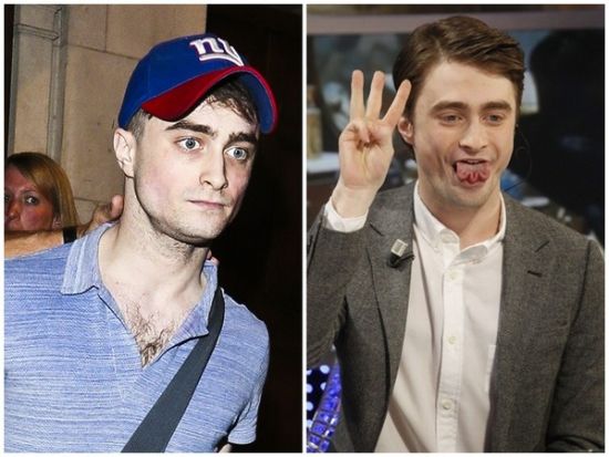 丹尼爾日前被拍到骨瘦如柴，不似2月份健康