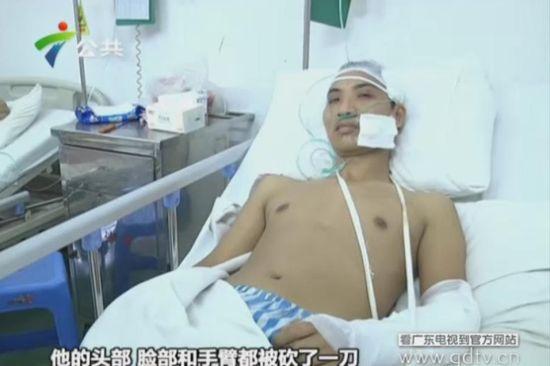 另一名傷者頭部、臉部和手臂都被砍了一刀。(視頻截圖)