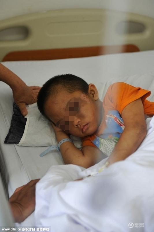 圖為全身傷痕累累的小進(jìn)。