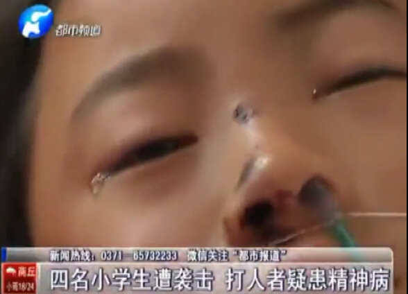 小學(xué)生突遭棍棒襲擊 傷勢嚴(yán)重